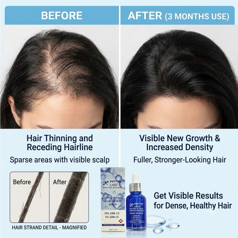 Essência para Crescimento Capi - Growth Factor Serum avaliação e preço