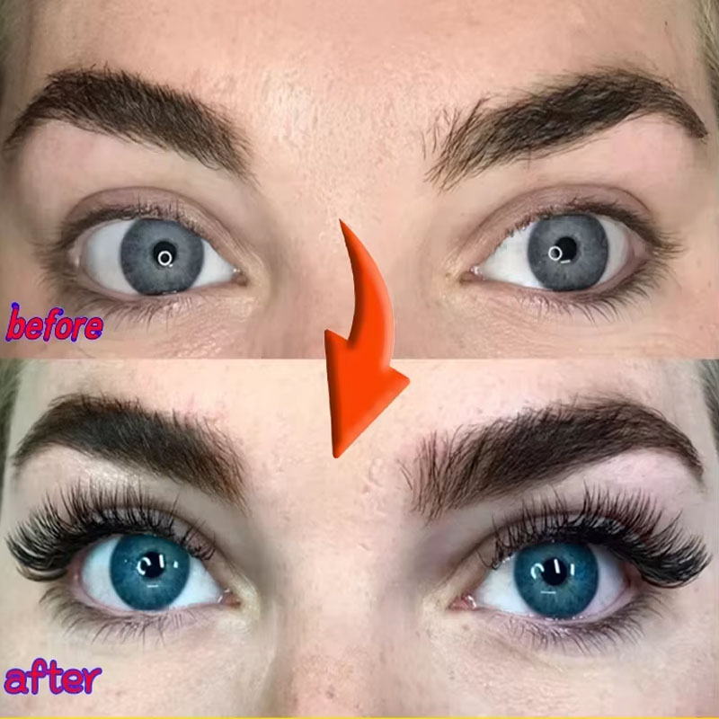 Soro de crescimento rápido de  - Growth Factor Serum avaliação e preço